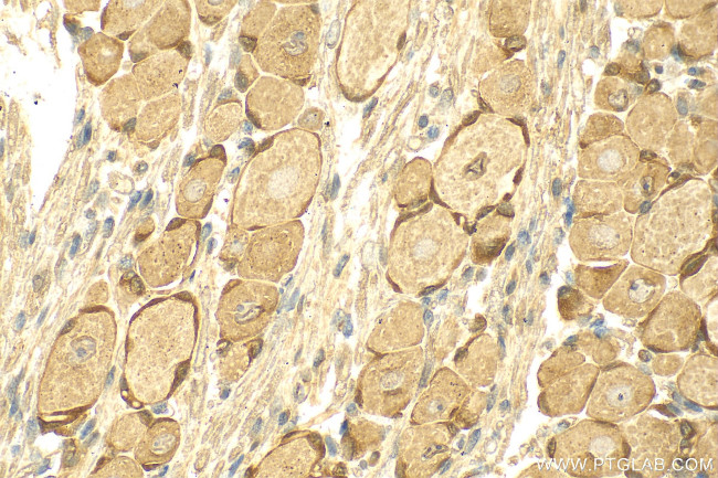 MRGPRE Antibody in Immunohistochemistry (Paraffin) (IHC (P))