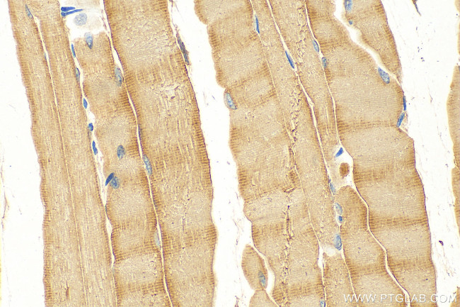 CYP26A1 Antibody in Immunohistochemistry (Paraffin) (IHC (P))
