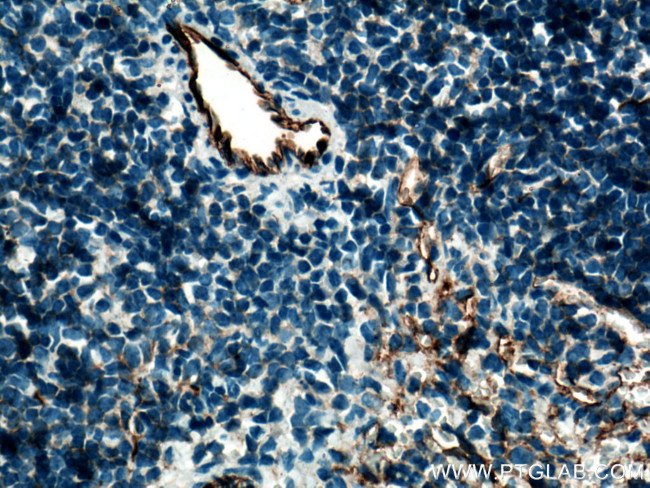 Cd31 Antibody in Immunohistochemistry (Paraffin) (IHC (P))