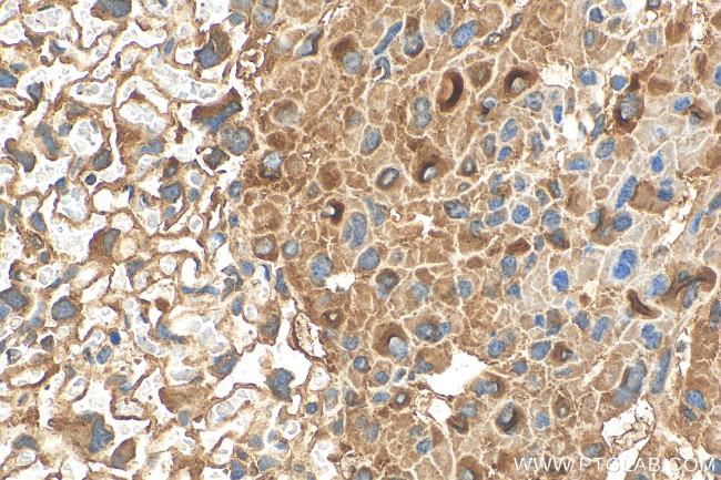 ALG3 Antibody in Immunohistochemistry (Paraffin) (IHC (P))