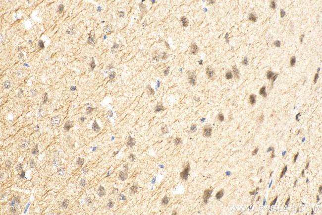 CAMK2N2 Antibody in Immunohistochemistry (Paraffin) (IHC (P))