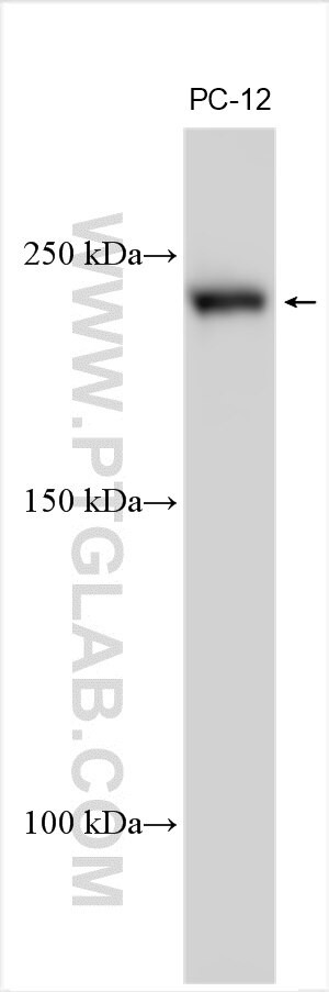 DMRTC2 Antibody in Western Blot (WB)