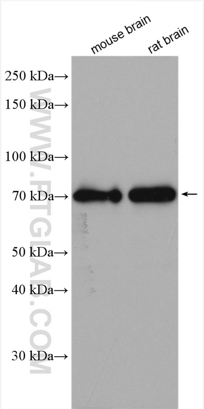 SLC38A5 Antibody in Western Blot (WB)