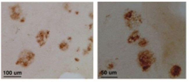 CLAC-P Antibody in Immunohistochemistry (Paraffin) (IHC (P))