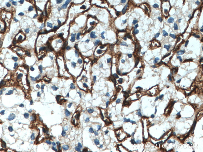 Endoglin/CD105 Antibody in Immunohistochemistry (Paraffin) (IHC (P))