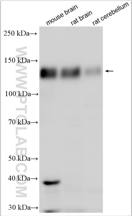 DLGAP1 Antibody in Western Blot (WB)