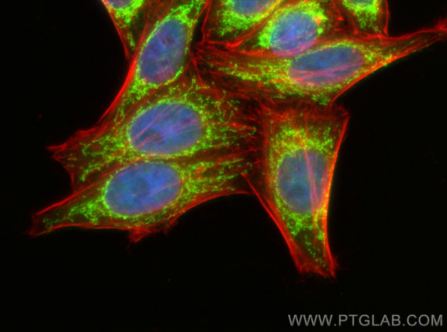 NDUFS2 Antibody in Immunocytochemistry (ICC/IF)