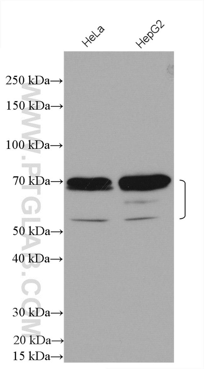 ZBTB7B Antibody in Western Blot (WB)