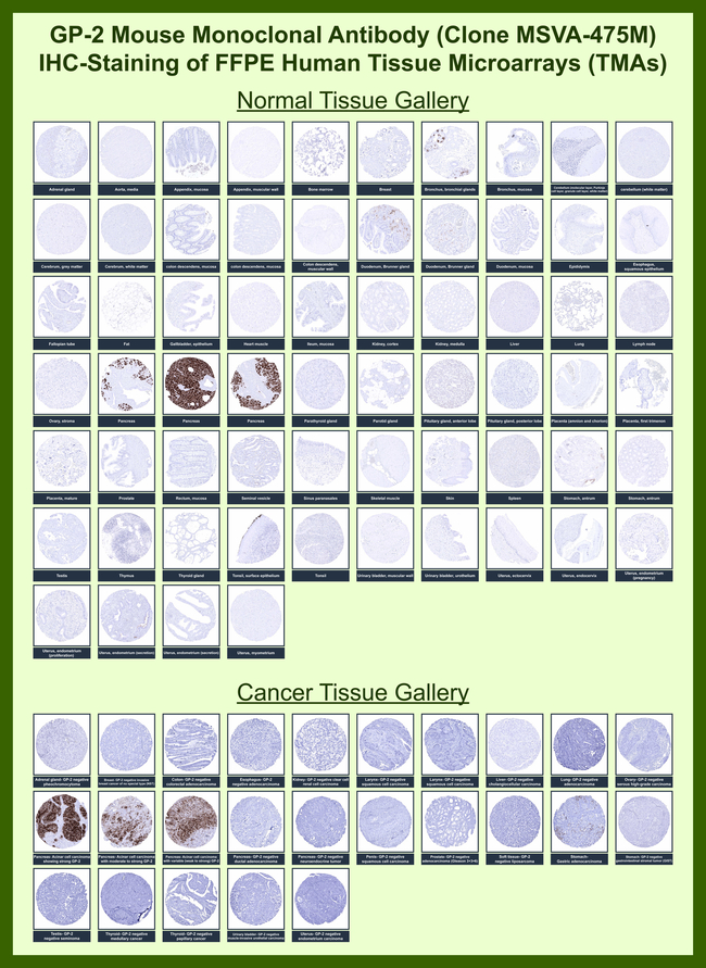 GP2 (Glycoprotein 2)/ZAP75 Antibody in Immunohistochemistry (Paraffin) (IHC (P))