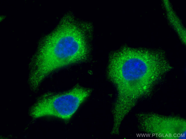 GSPT1 Antibody in Immunocytochemistry (ICC/IF)
