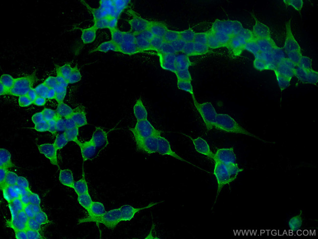 DPP6 Antibody in Immunocytochemistry (ICC/IF)