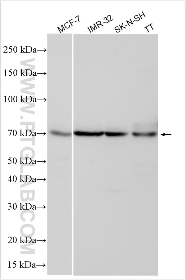 DOT1L Antibody in Western Blot (WB)
