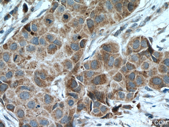 CCDC71 Antibody in Immunohistochemistry (Paraffin) (IHC (P))