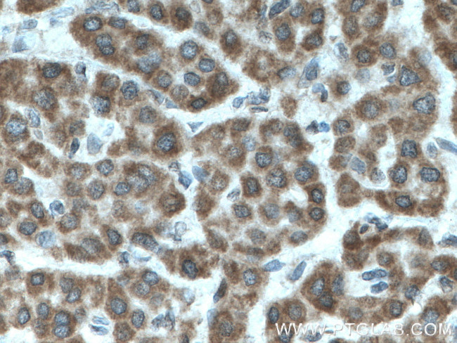 TENC1 Antibody in Immunohistochemistry (Paraffin) (IHC (P))