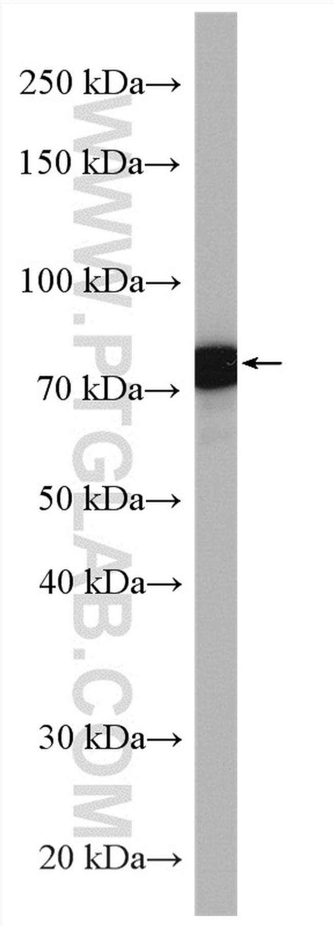 PLEKHH3 Antibody in Western Blot (WB)