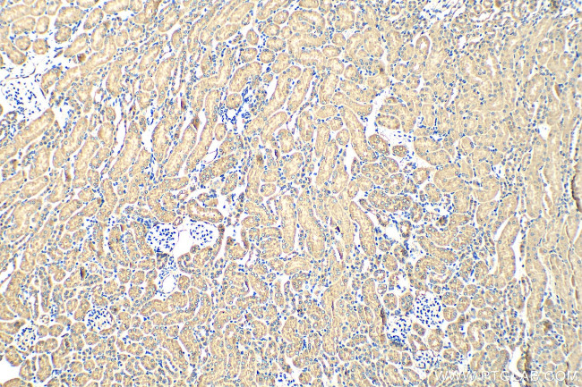 WNT3 Antibody in Immunohistochemistry (Paraffin) (IHC (P))