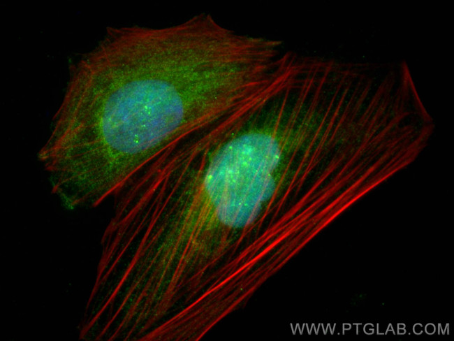 CDADC1 Antibody in Immunocytochemistry (ICC/IF)