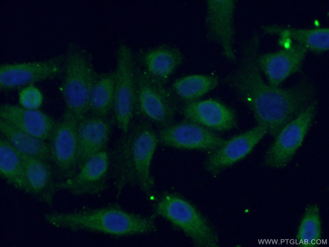 CDC123/C10orf7 Antibody in Immunocytochemistry (ICC/IF)