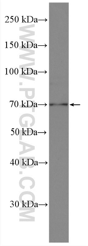 ZC3H14 Antibody in Western Blot (WB)