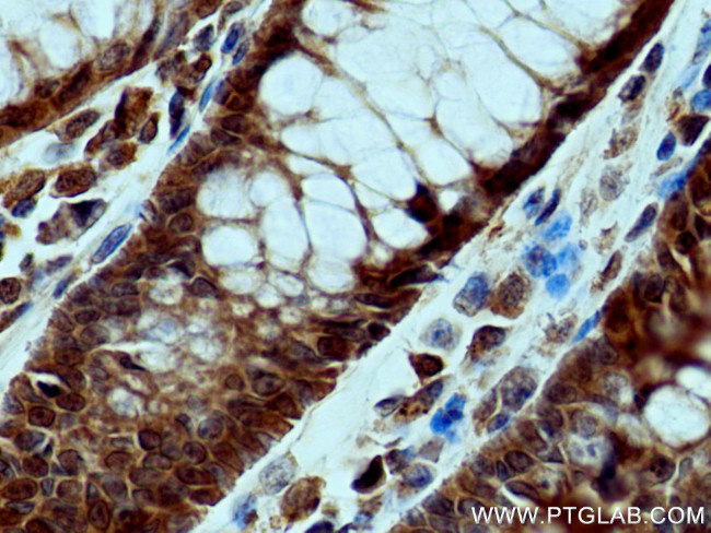FES Antibody in Immunohistochemistry (Paraffin) (IHC (P))