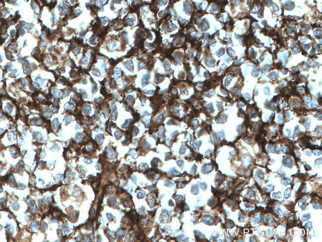 CD21 Antibody in Immunohistochemistry (Paraffin) (IHC (P))