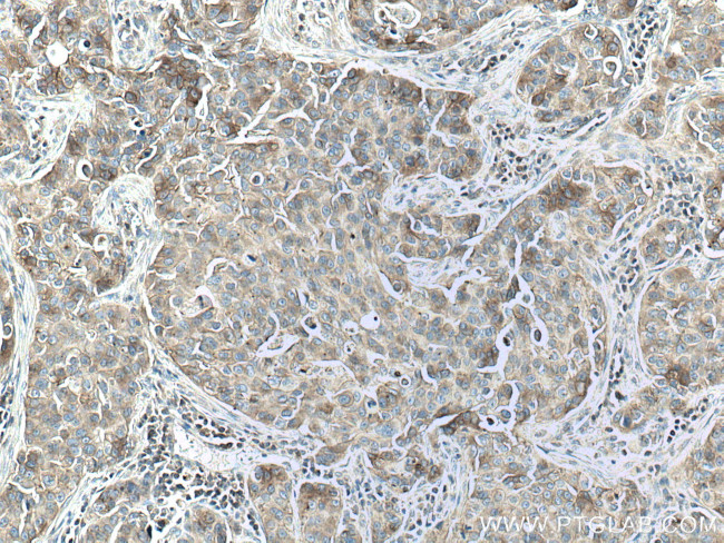 Flotillin 2 Antibody in Immunohistochemistry (Paraffin) (IHC (P))