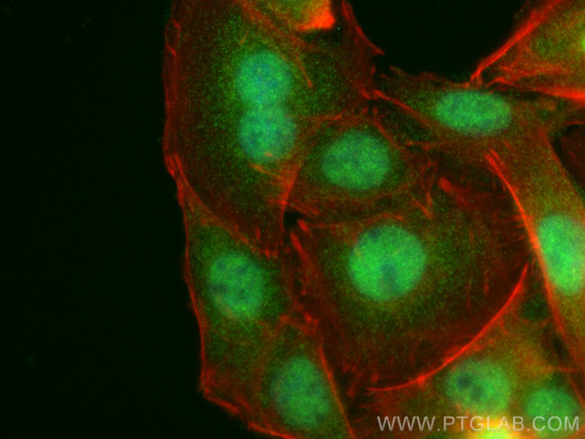 RAI2 Antibody in Immunocytochemistry (ICC/IF)
