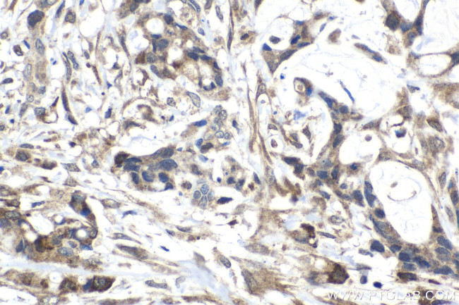 FSTL3 Antibody in Immunohistochemistry (Paraffin) (IHC (P))