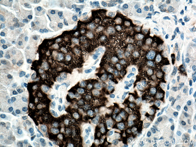 PCSK1 Antibody in Immunohistochemistry (Paraffin) (IHC (P))