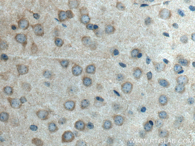 HTR5A Antibody in Immunohistochemistry (Paraffin) (IHC (P))