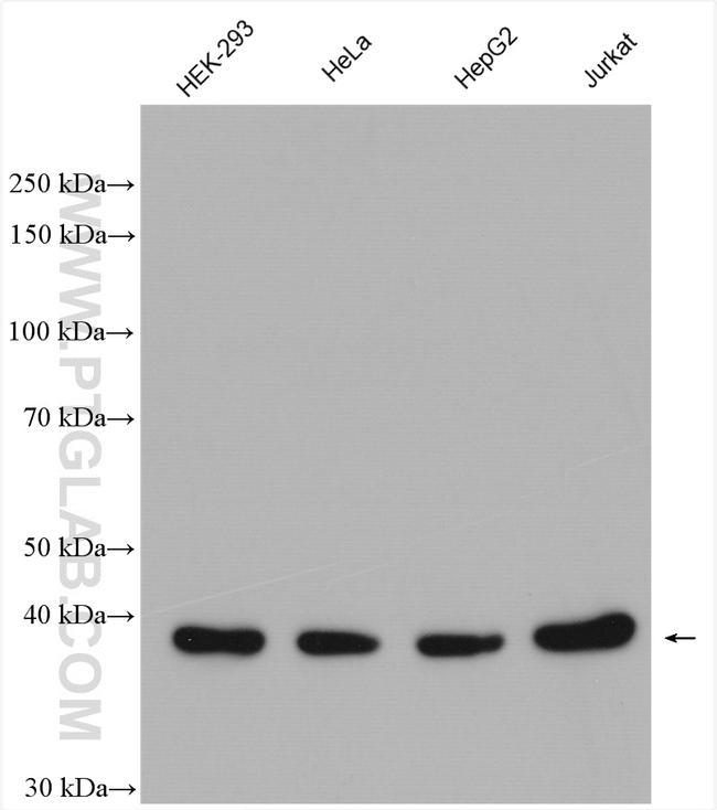 KTI12 Antibody in Western Blot (WB)