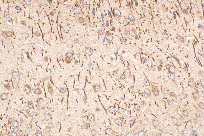 CXCR5 Antibody in Immunohistochemistry (Paraffin) (IHC (P))