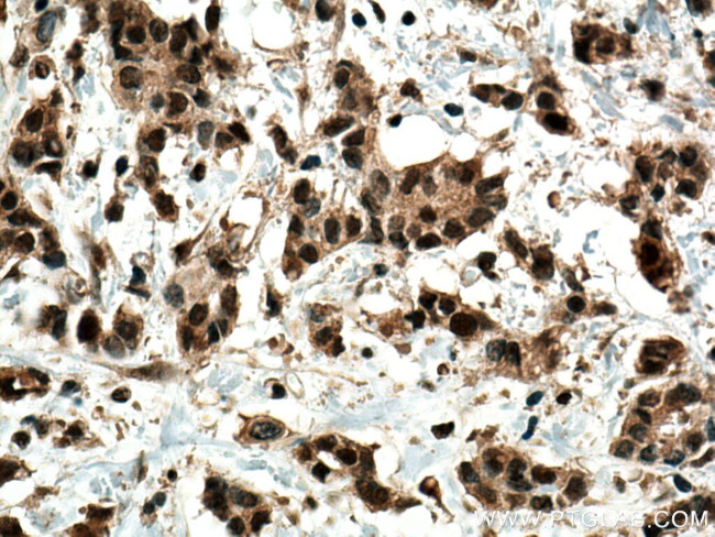GLI2 Antibody in Immunohistochemistry (Paraffin) (IHC (P))