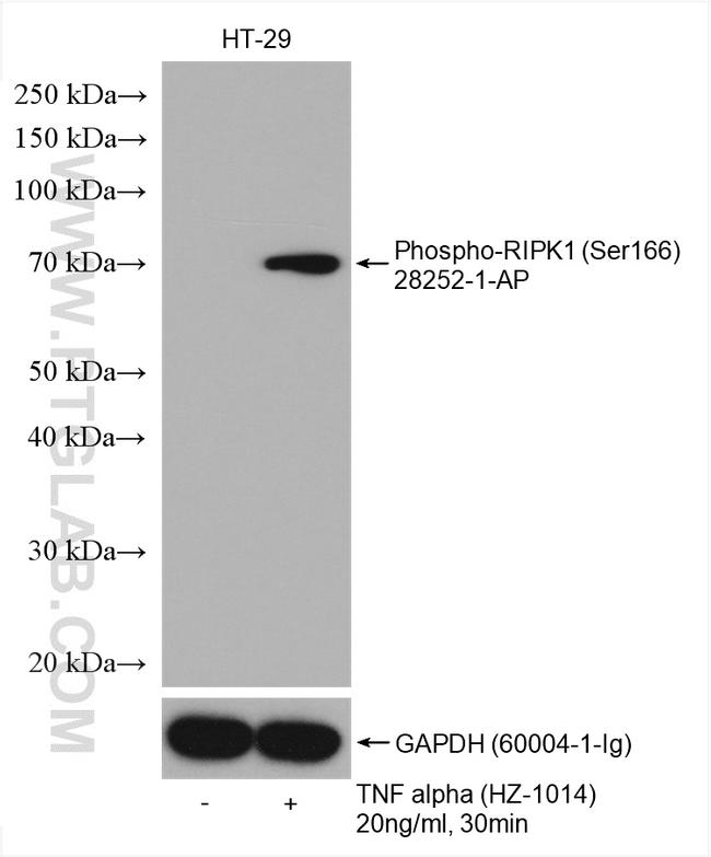 Phospho-RIPK1 (Ser166) Antibody in Western Blot (WB)