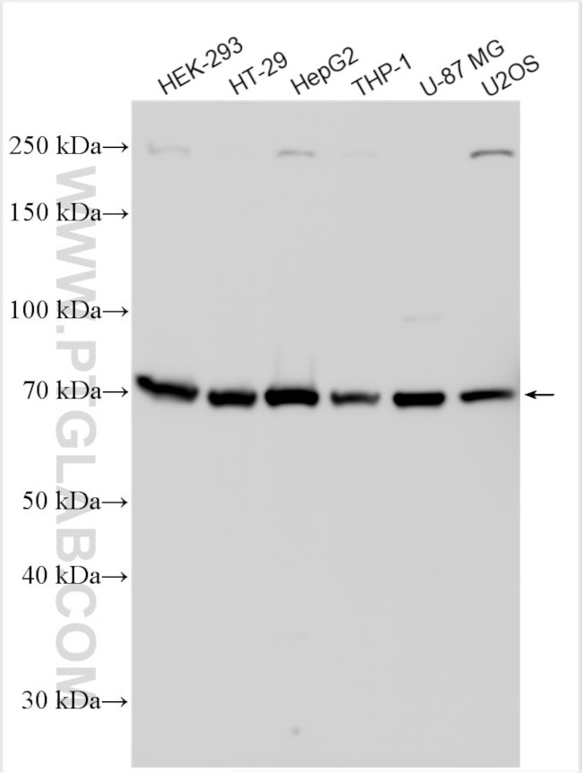RNF139 Antibody in Western Blot (WB)