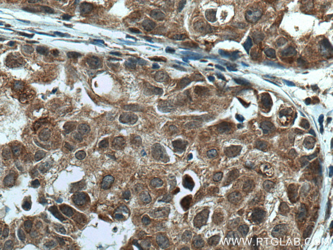 TMEM192 Antibody in Immunohistochemistry (Paraffin) (IHC (P))