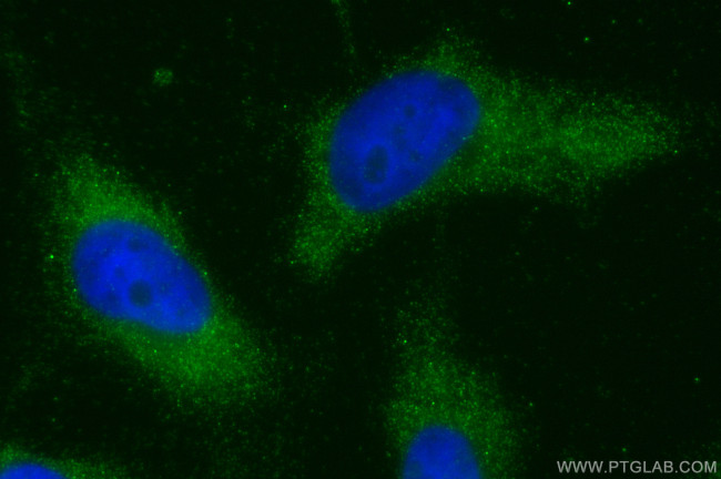 Calmodulin 1/2/3 Antibody in Immunocytochemistry (ICC/IF)