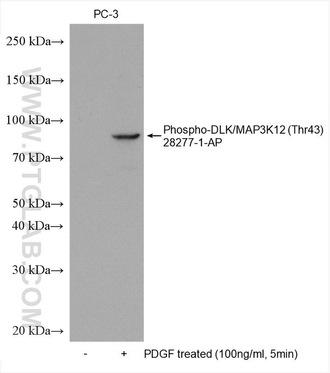Phospho-DLK/MAP3K12 (Thr43) Antibody in Western Blot (WB)