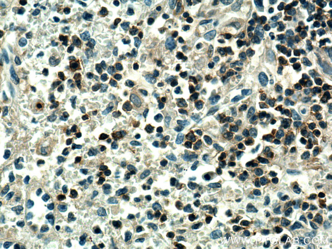 PTPRCAP Antibody in Immunohistochemistry (Paraffin) (IHC (P))