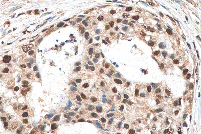 IPO7 Antibody in Immunohistochemistry (Paraffin) (IHC (P))