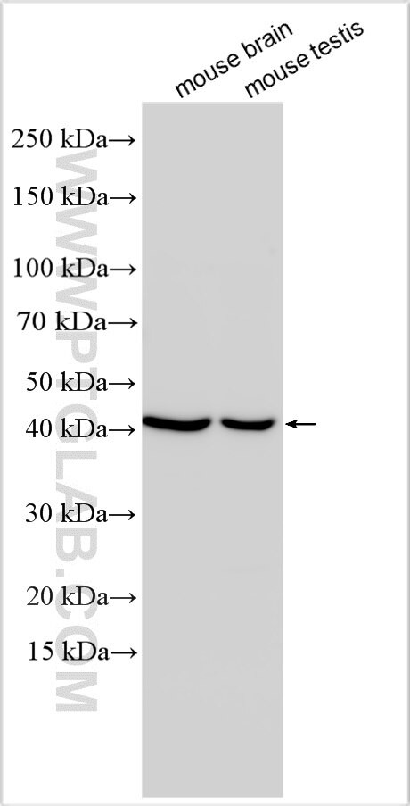 FOXJ2 Antibody in Western Blot (WB)