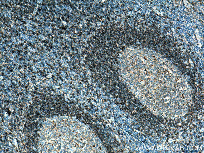 CD180 Antibody in Immunohistochemistry (Paraffin) (IHC (P))
