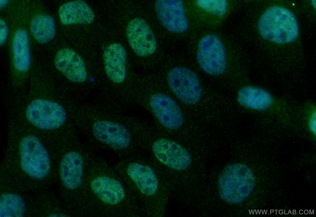 RBM48 Antibody in Immunocytochemistry (ICC/IF)
