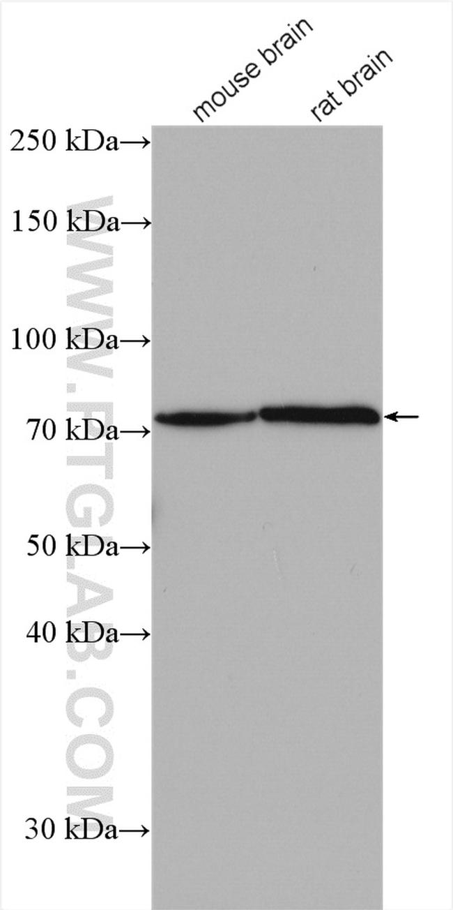 EOMES/TBR2 Antibody in Western Blot (WB)