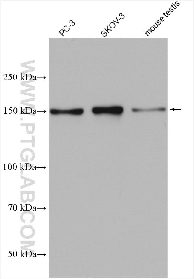 PDS5B Antibody in Western Blot (WB)