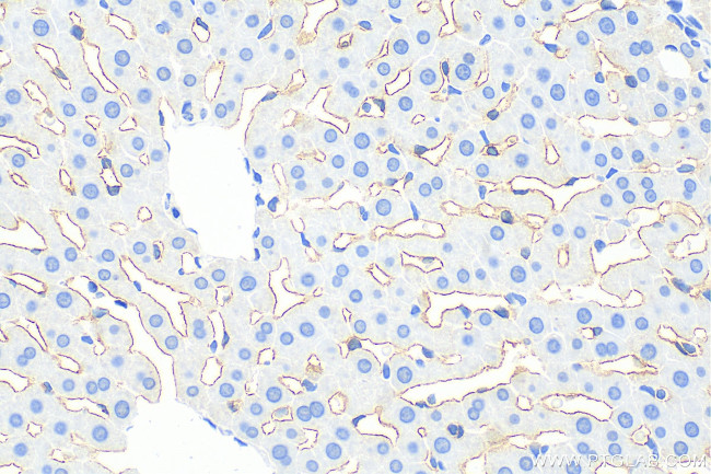 LYVE1 Antibody in Immunohistochemistry (Paraffin) (IHC (P))