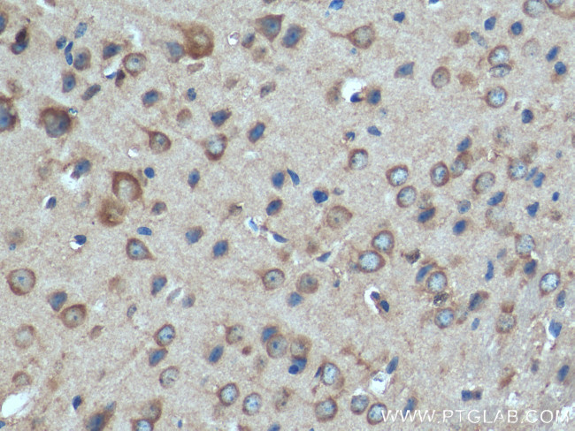 GIPR Antibody in Immunohistochemistry (Paraffin) (IHC (P))