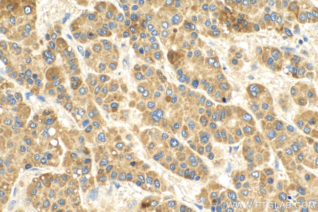 RALGAPB Antibody in Immunohistochemistry (Paraffin) (IHC (P))