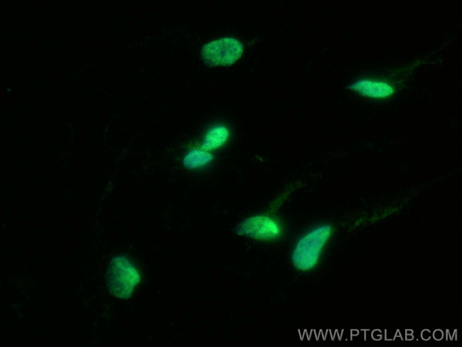 HDAC9 Antibody in Immunocytochemistry (ICC/IF)