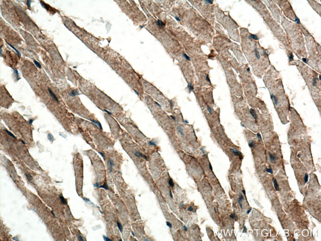 MFN2 Antibody in Immunohistochemistry (Paraffin) (IHC (P))